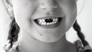 studio-ghidini-bologna-dentista-pediatrico-pedodonzia-bambini-2