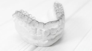 ortodonzia-invisibile-studio-medico-dentistico-ghidini-bologna-castiglionedellestiviere