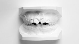 ortodonzia-intercettiva-studio-medico-ghidini-dentista-bologna-castiglione-stiviere-3